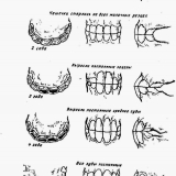 Kako odrediti starost konja